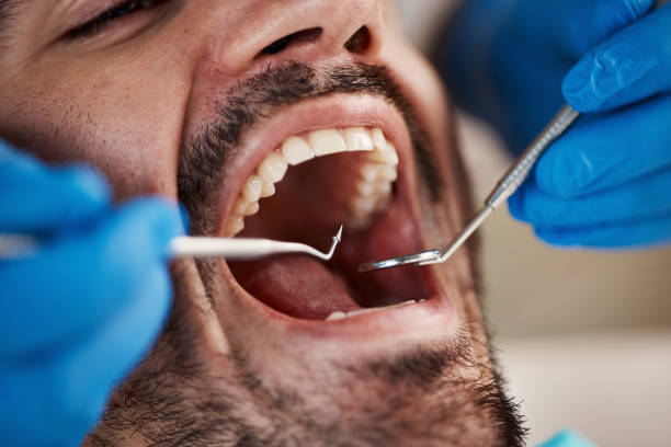 Best Broken or Cracked Tooth Emergency Dentist in San Luis Obispo, CA
