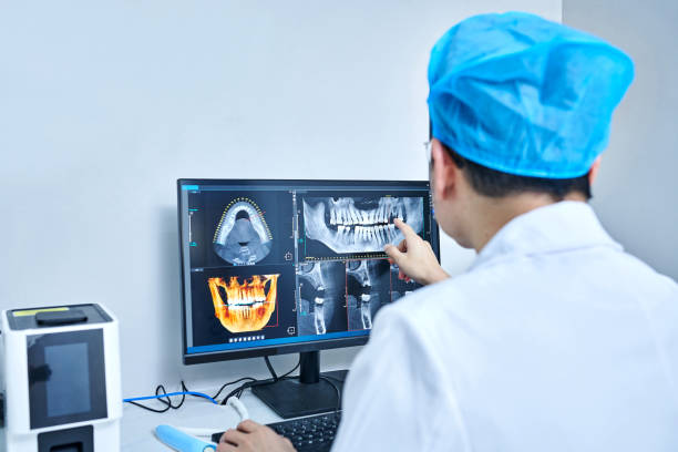 Best Emergency Dentist for Lost Fillings or Crowns in San Luis Obispo, CA